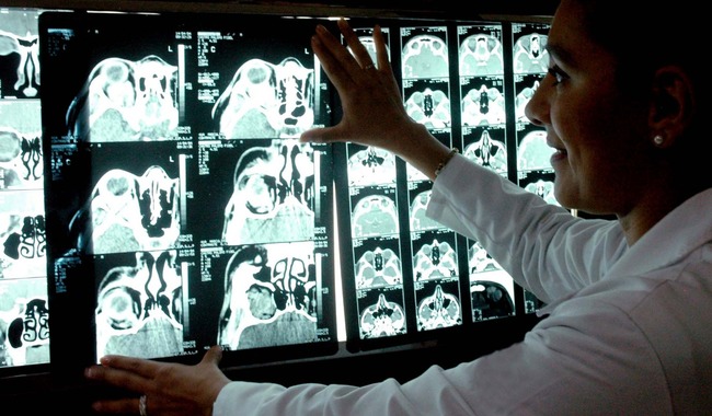 428. Personal experto del Instituto Nacional de Neurología ha capacitado 3 mil profesionales sobre ictus